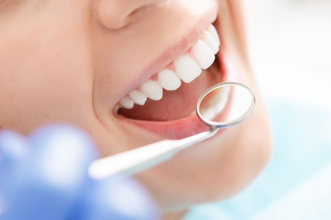 Dlaczego należy regularnie chodzić na przegląd zębów?