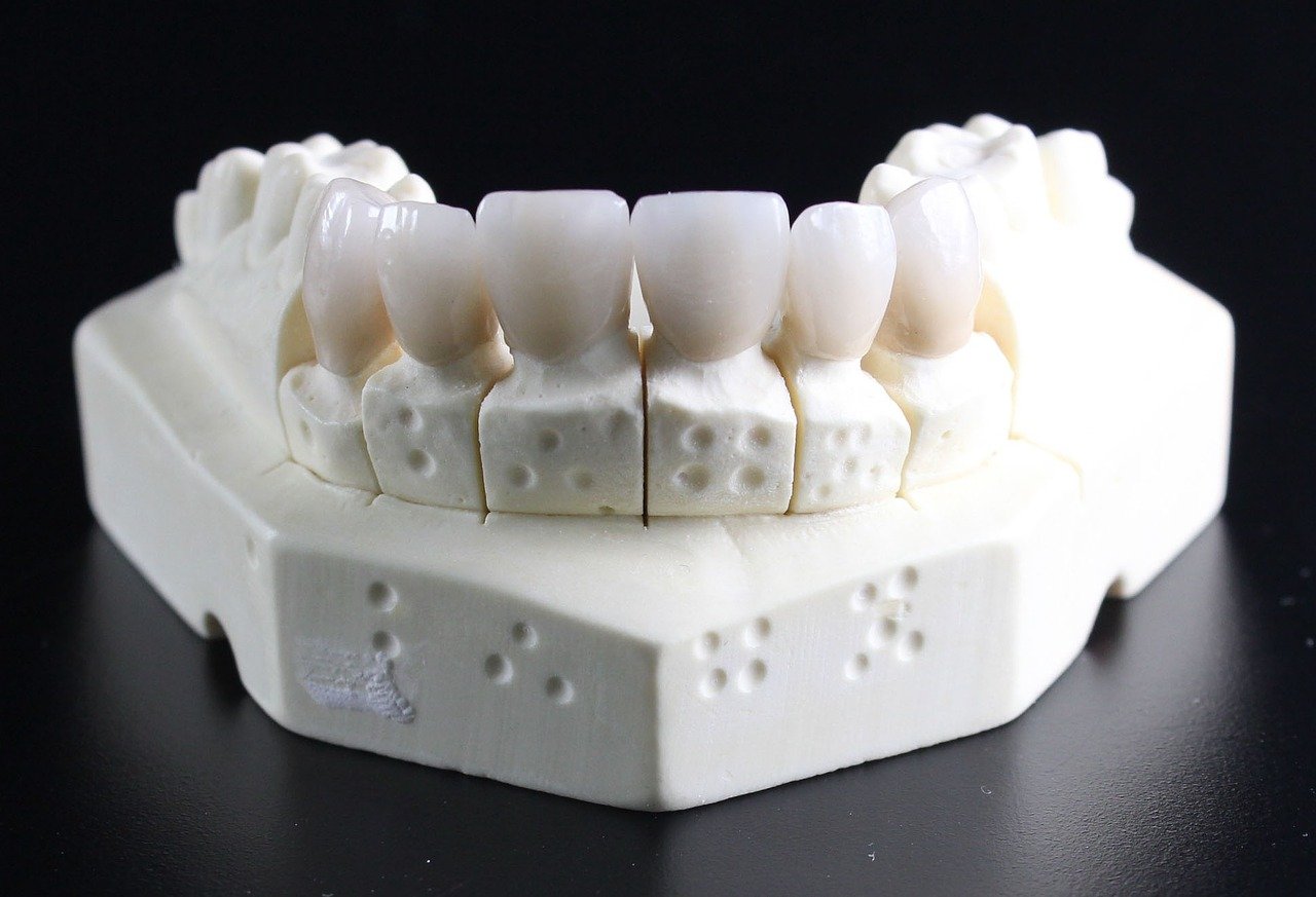 Protetyka zębowa – jakie rozwiązania są przez nią oferowane?